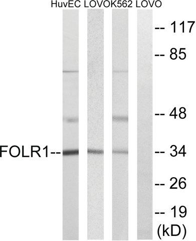 Anti-FOLR1 antibody produced in rabbit