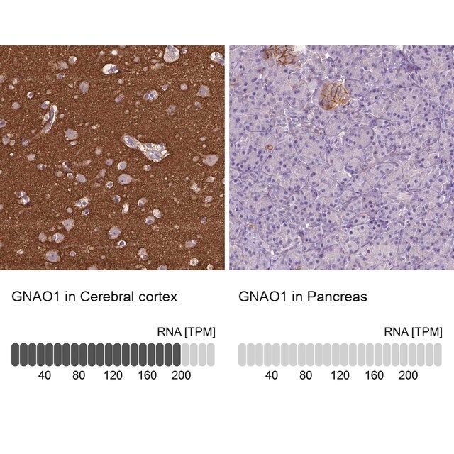 Anti-GNAO1 antibody produced in rabbit