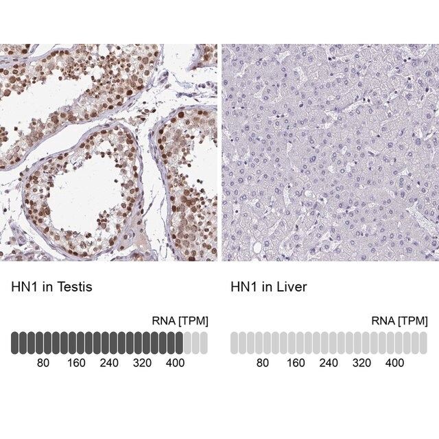 Anti-HN1 antibody produced in rabbit