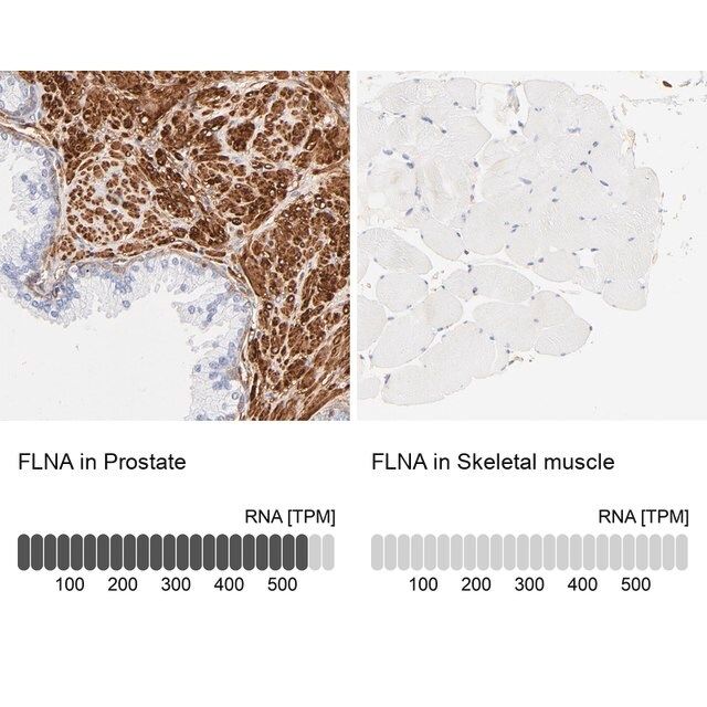 Anti-FLNA antibody produced in rabbit