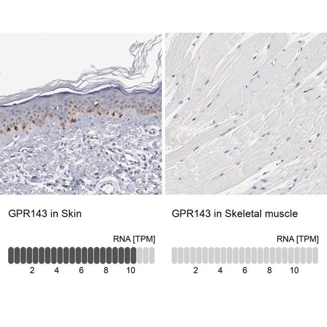 Anti-GPR143 antibody produced in rabbit