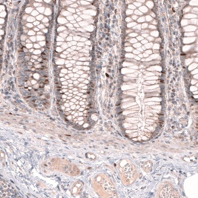 Anti-FOXM1 antibody produced in rabbit