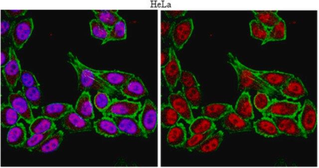 Anti-FoxP4 Antibody