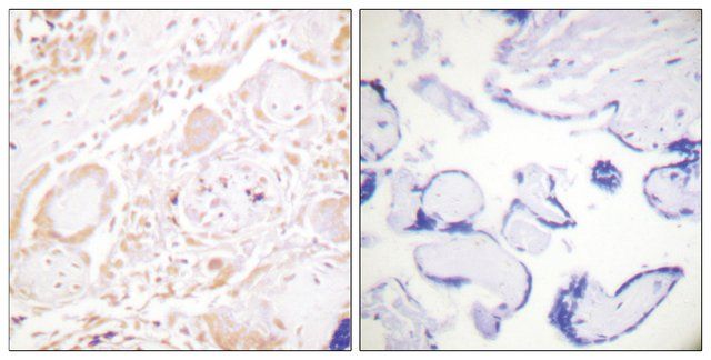 Anti-GATA3 antibody produced in rabbit