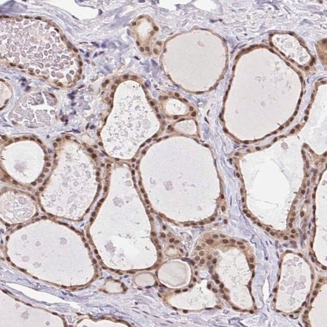 Anti-GLIS3 antibody produced in rabbit