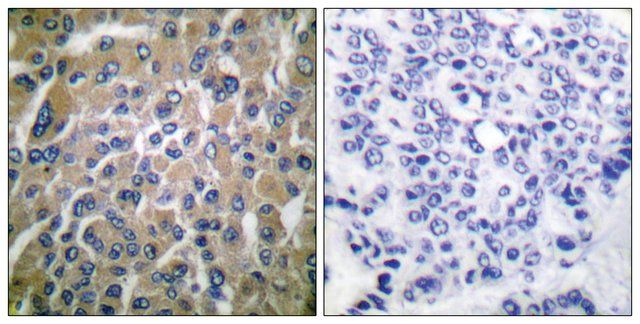 Anti-HCG  antibody produced in rabbit