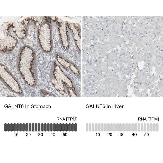 Anti-GALNT6 antibody produced in rabbit