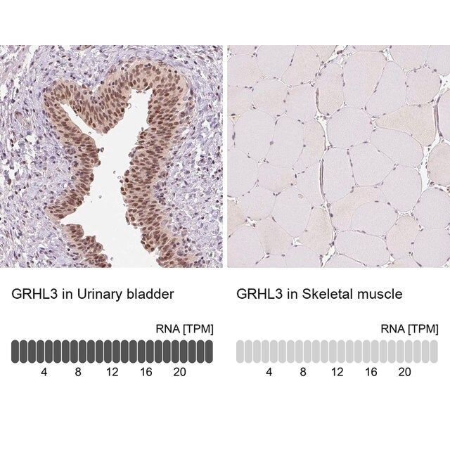 Anti-GRHL3 antibody produced in rabbit