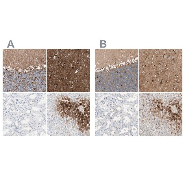 Anti-GLUL antibody produced in rabbit