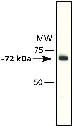 Anti-Histone Deacetylase 10 (HDAC10) antibody produced in rabbit