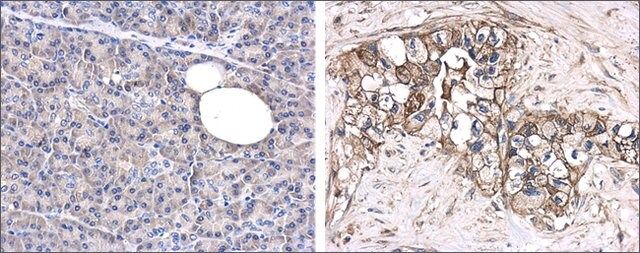 Anti-GPC1 antibody produced in rabbit