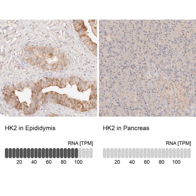 Anti-HK2 antibody produced in rabbit