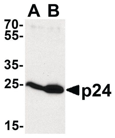 Anti-HIV-1 P24 antibody produced in rabbit