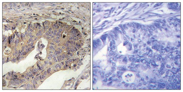 Anti-Fibrillin-1 antibody produced in rabbit