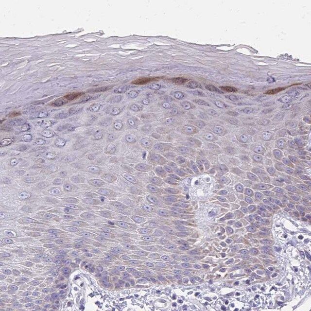 Anti-IL37 antibody produced in rabbit