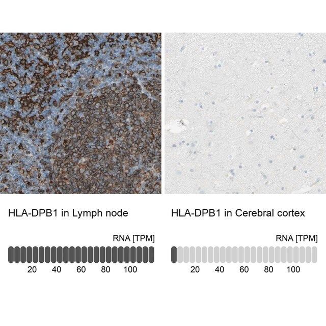 Anti-HLA-DPB1 antibody produced in rabbit