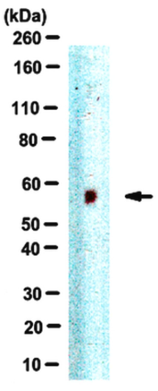 Anti-Jarid2 Antibody