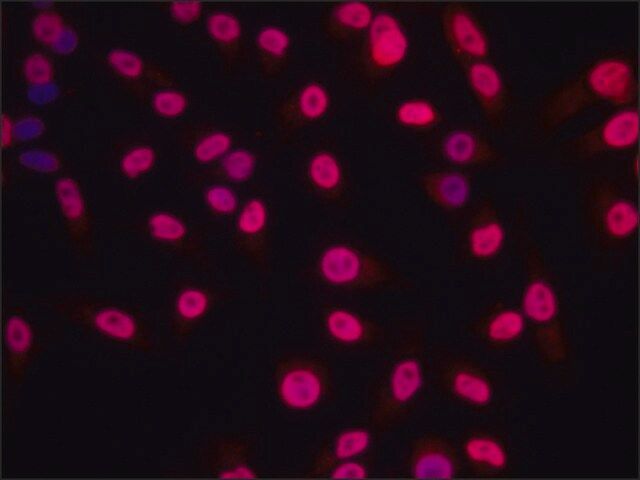 Anti-Histone H1.4 antibody produced in rabbit