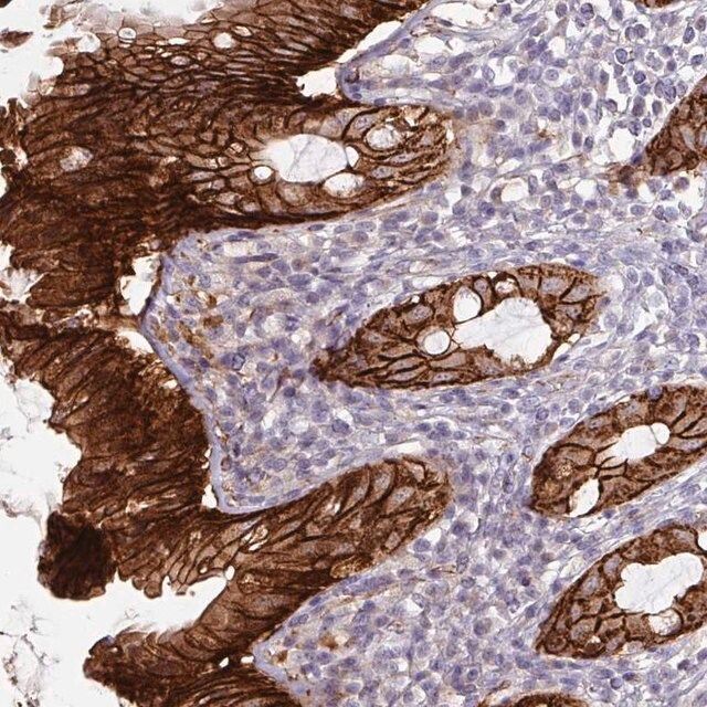 Anti-JUP antibody produced in rabbit