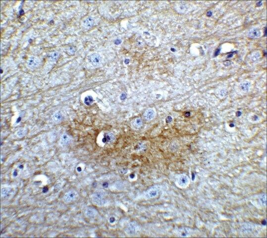 Anti-GLS2 antibody produced in rabbit