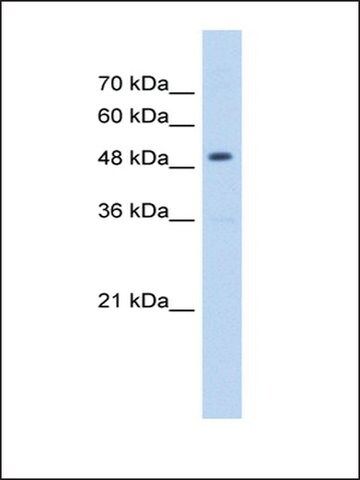 Anti-HMGCS2 antibody produced in rabbit