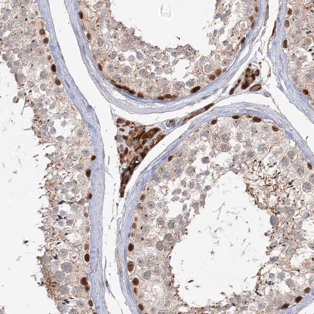 Anti-KBTBD4 antibody produced in rabbit