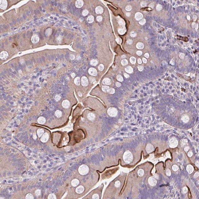 Anti-IL1R1 antibody produced in rabbit