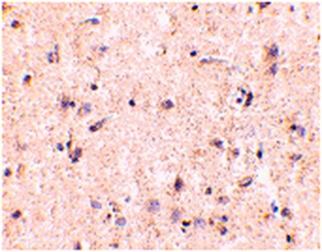 Anti-IRGM Antibody