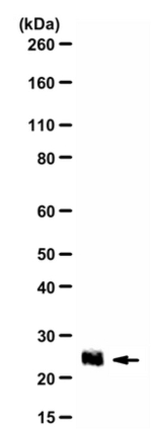 Anti-IGF2 Antibody