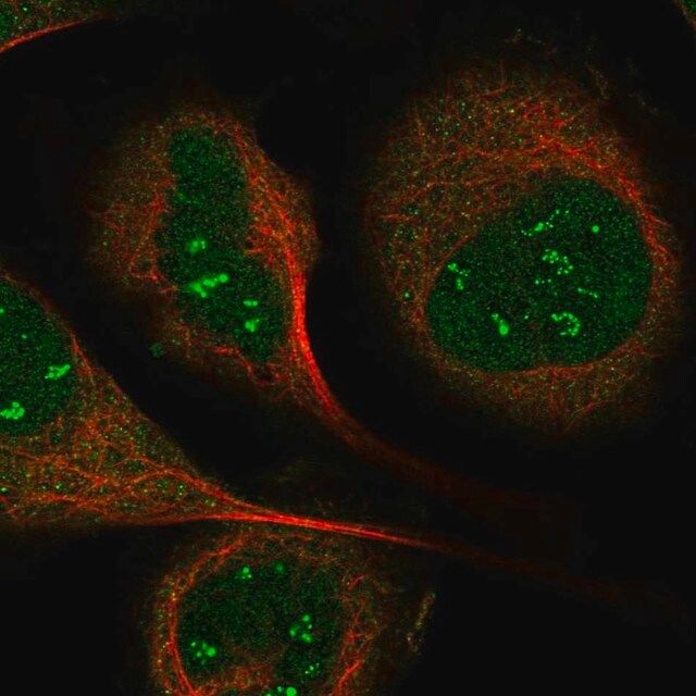 Anti-IP6K1 antibody produced in rabbit