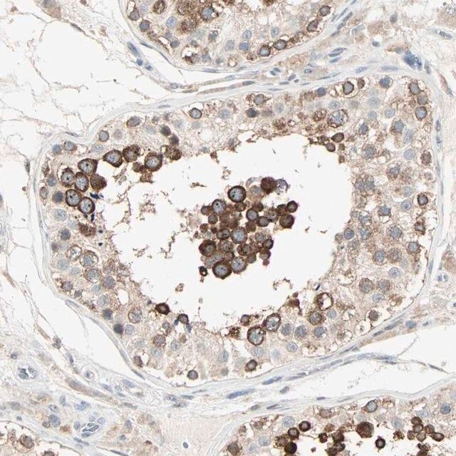 Anti-KDM4A antibody produced in rabbit