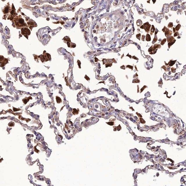 Anti-IRAK3 antibody produced in rabbit