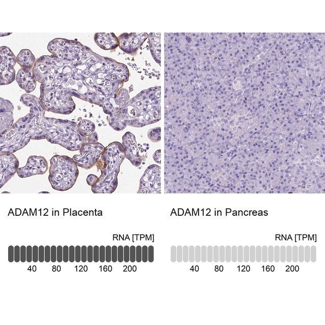 Anti-ADAM12 antibody produced in rabbit