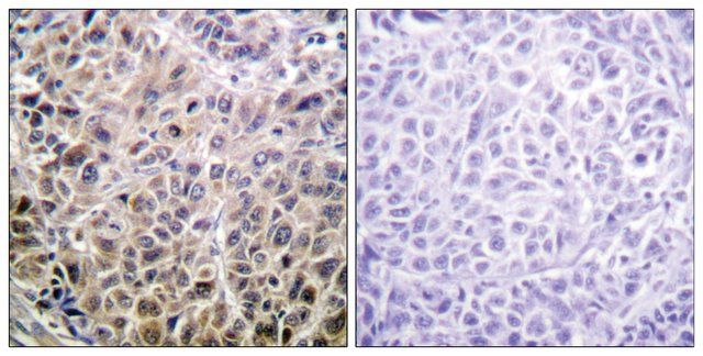 Anti-DAPK1 antibody produced in rabbit