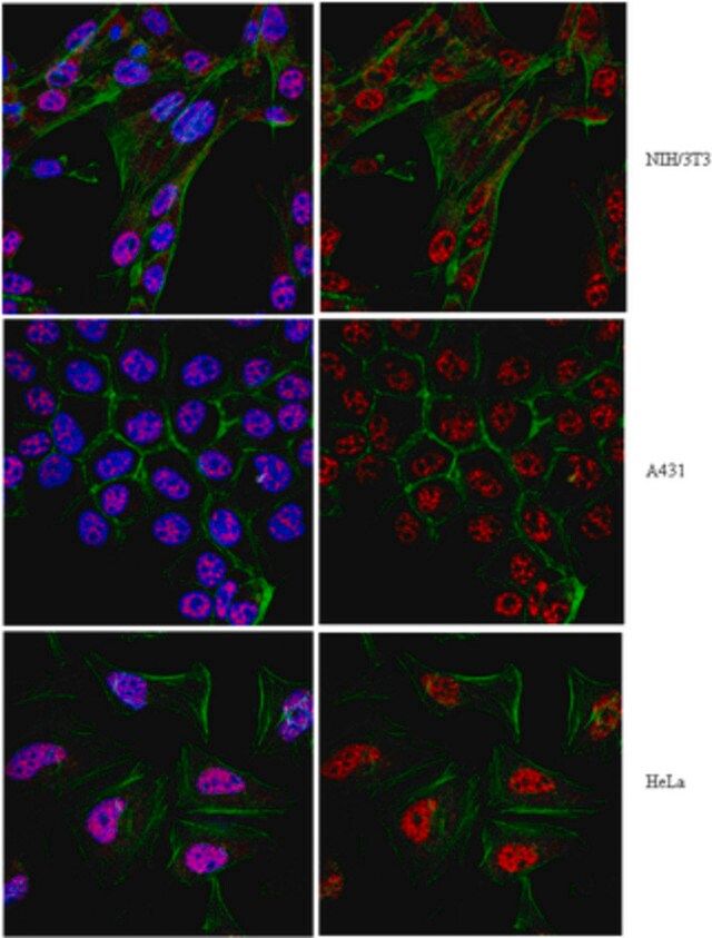 Anti-Twist1 (Twist-related protein 1) Antibody