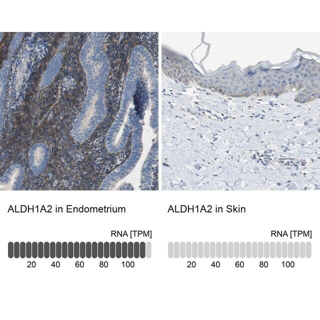 Anti-ALDH1A2 antibody produced in rabbit