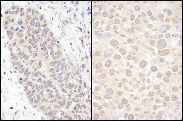 Rabbit anti-FOXO3a Antibody, Affinity Purified