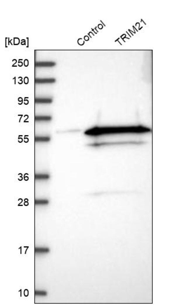 Anti-TRIM21 antibody produced in rabbit