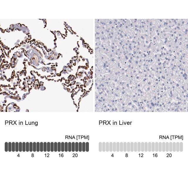 Anti-PRX antibody produced in rabbit