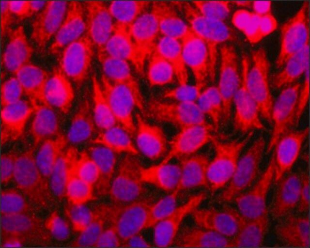 Anti-STUB1/CHIP antibody, mouse monoclonal