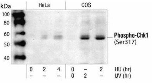 PhosphoDetect Anti-Chk1 (pSer<sup>3</sup><sup>1</sup><sup>7</sup>) Rabbit pAb