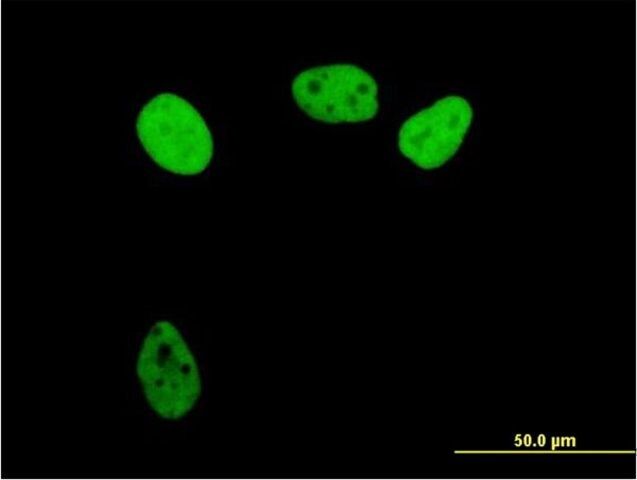 Anti-RPA1 antibody produced in mouse