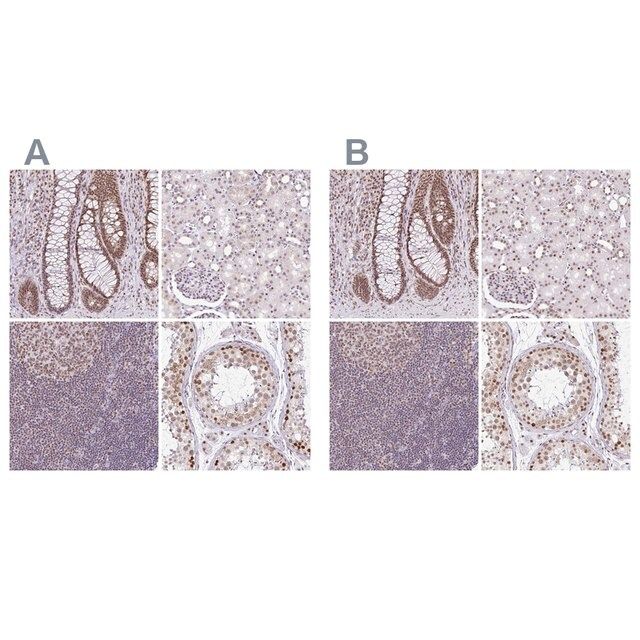 Anti-PTPN2 antibody produced in rabbit