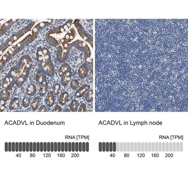 Anti-ACADVL antibody produced in rabbit