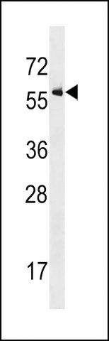 ANTI-ACTIVIN RECEPTOR TYPE IA (ACVR1) (CENTER R147) antibody produced in rabbit