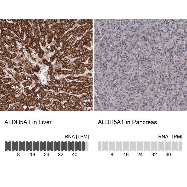 Anti-ALDH5A1 antibody produced in rabbit