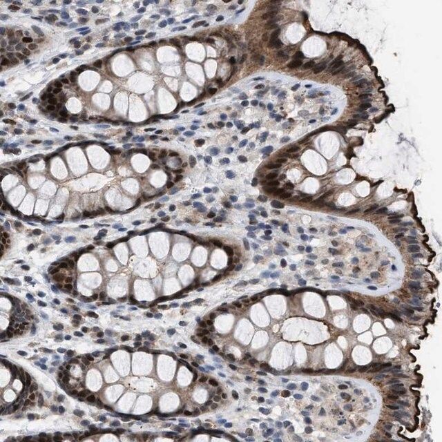 Anti-SETDB1 antibody produced in rabbit