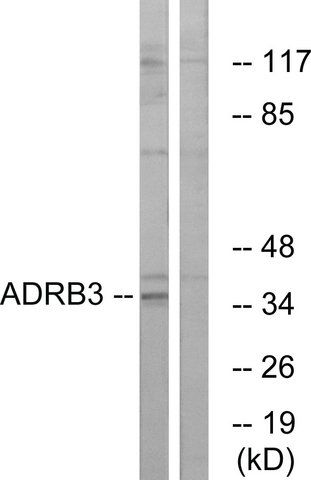 Anti-ADRB3 antibody produced in rabbit