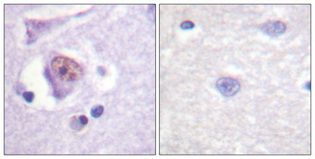 Anti-SOX9 antibody produced in rabbit