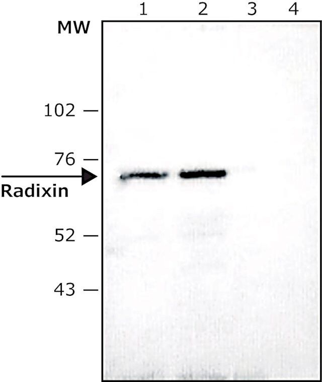 Anti-Radixin antibody produced in rabbit